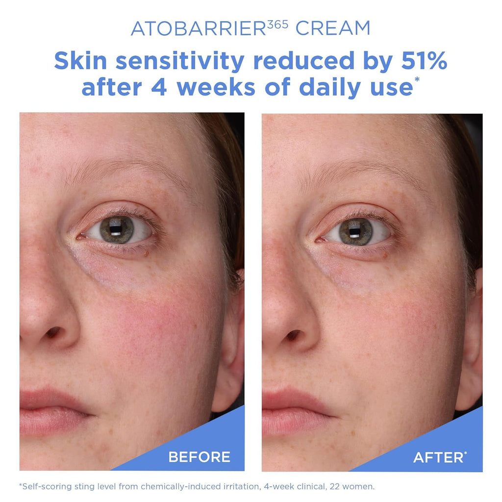 AESTURA | ATOBARRIER365 Cream | 80 mL