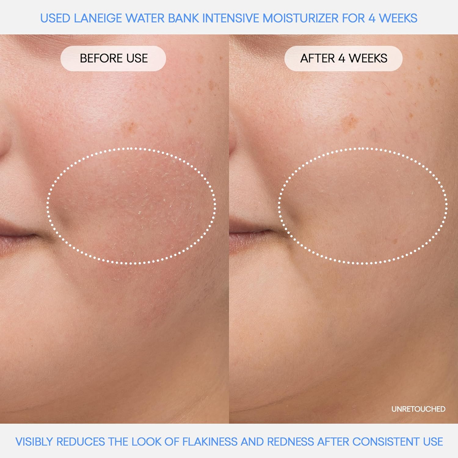 LANEIGE | Water Bank Blue Hyaluronic Intensive Moisturizer | 50 mL